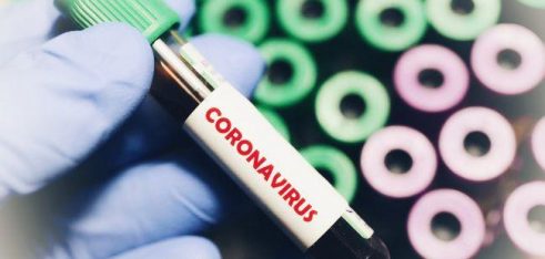 Протидія поширенню коронавірусу: які Верховна Рада прийняла нововведення